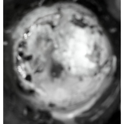 SelmoDarloula